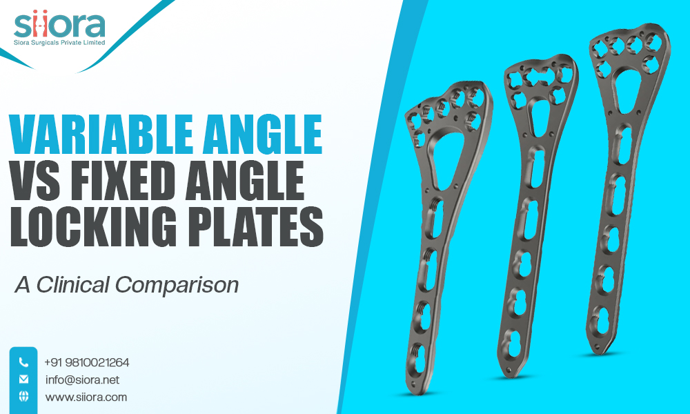 Variable Angle vs Fixed Angle Locking Plates: A Clinical&nbsp;Comparison
